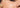 A Quick Guide: Nano vs Micro-needling - by Kin Aesthetics