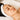 KrX CO2 Carboxy Therapy - by Kin Aesthetics 
