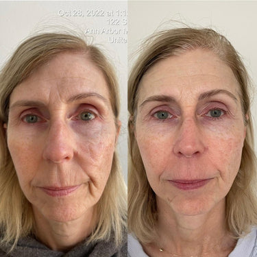 KrX Youthplex Face Lift Cream - by Kin Aesthetics 